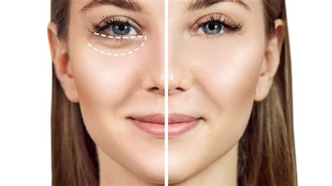 fake under eye bags